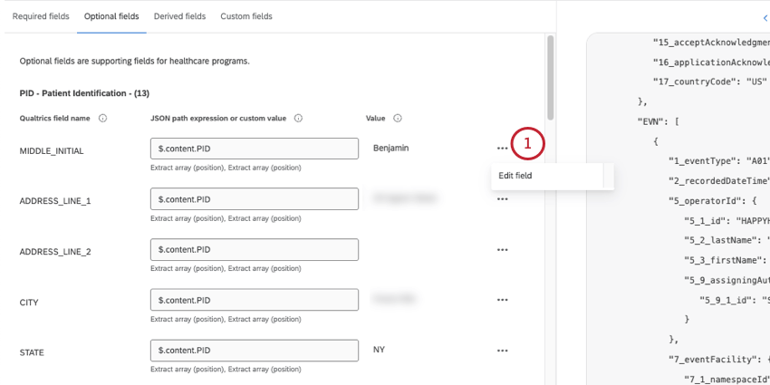 edit field button is shown