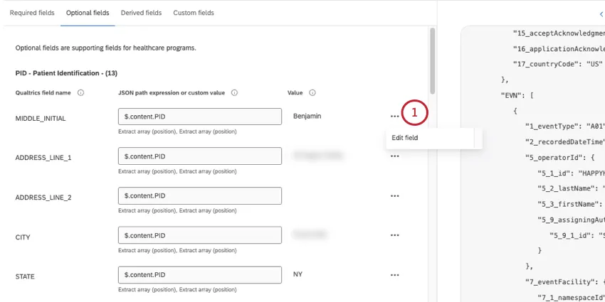 edit field button is shown